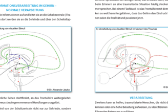 Dr. Jatzko: Was passiert bei einem Trauma im Gehirn?