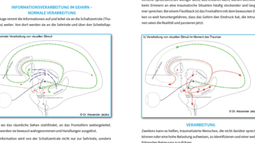Dr. Jatzko: Was passiert bei einem Trauma im Gehirn?
